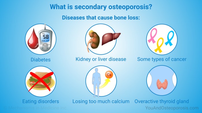 Bone health and osteoporosis prevention